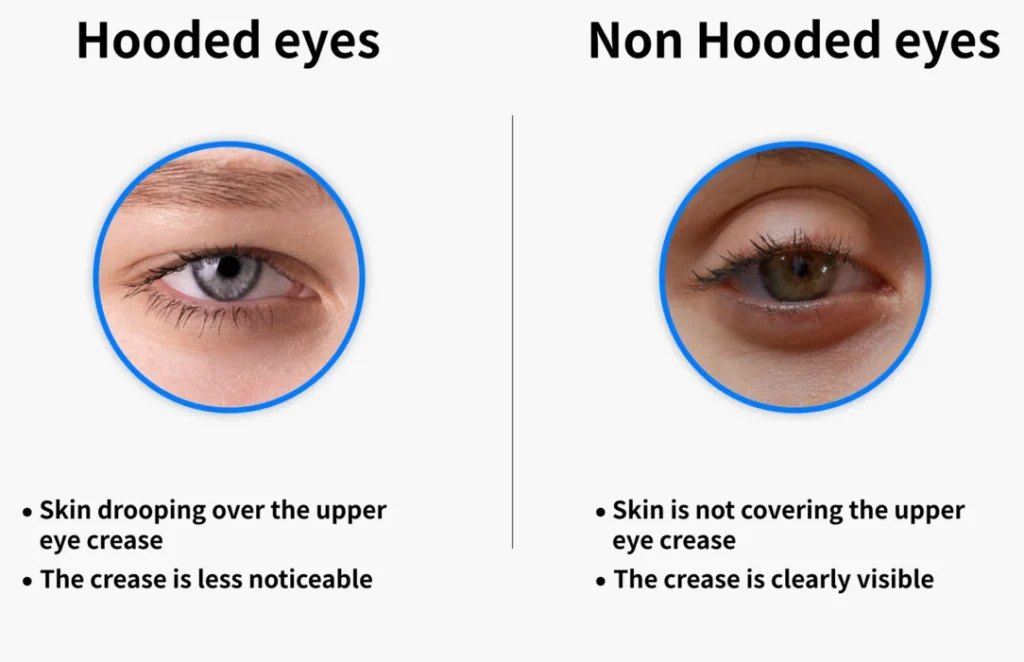 Showing Hooded Eyes Vs Normal Eyes